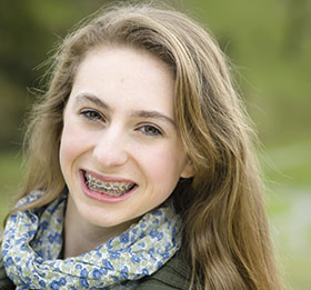 life with braces